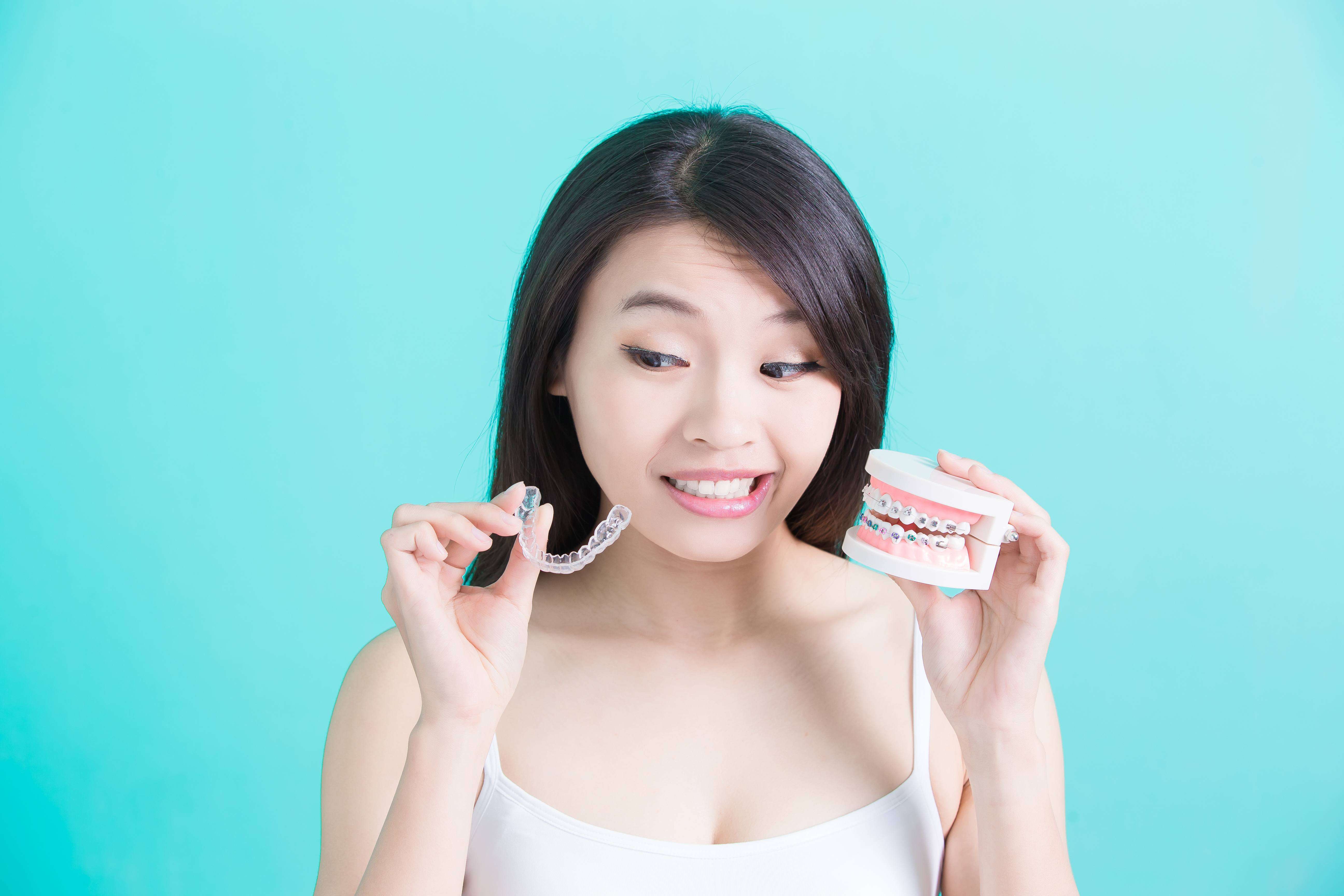 Invisalign Erfahrungen – ACHTUNG! Das sollten Sie vorher wissen!